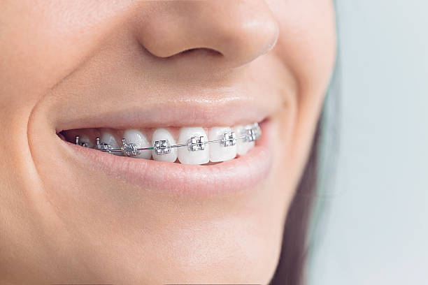 Dental Inlays and Onlays in Ferndale, MD